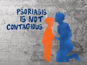 Psoriasis is not contagious by Stacey Stent